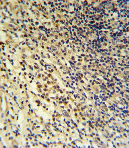 PLA2G7 Antibody