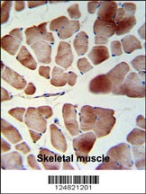 PATL1 Antibody