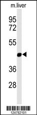 MMAA Antibody