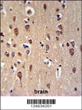 GRPR Antibody