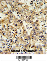 CA6 Antibody