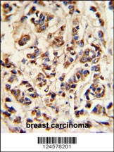ATP6V1A Antibody