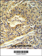 ATP5A1 Antibody