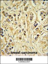 ZNF202 Antibody