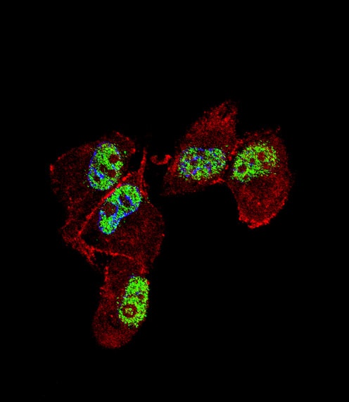 ZNF202 Antibody