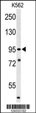 SUPV3L1 Antibody