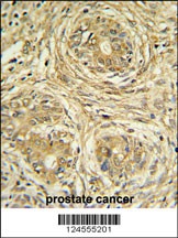 SUPV3L1 Antibody