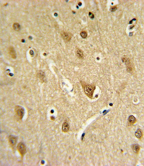 ST8SIA4 Antibody