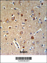 HSPA12A Antibody