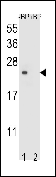 TM4SF4 Antibody