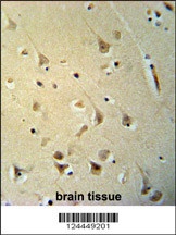 P2R3C Antibody