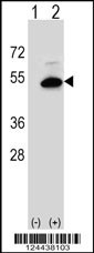 SGMS2 Antibody