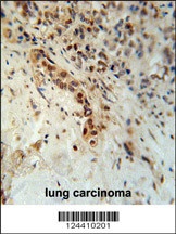 DCLRE1C Antibody