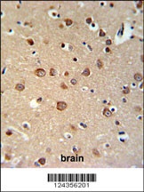 PDE6C Antibody