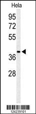 ADPRHL2 Antibody