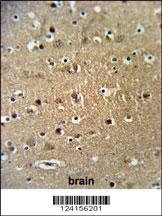 STRIP1 Antibody