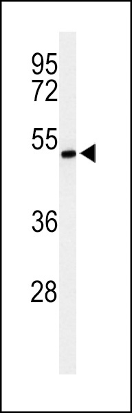 ZDHHC9 Antibody