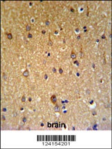 ZDHHC9 Antibody