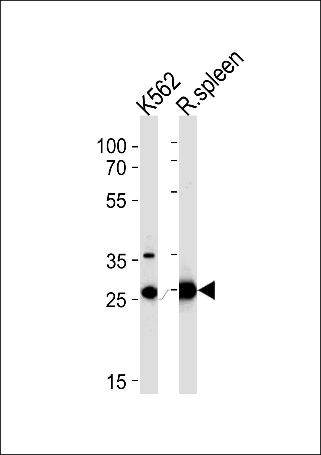 SLC25A37 Antibody