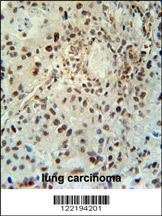 ABHEB Antibody