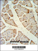 HFE2 Antibody