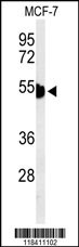 KRT1 Antibody