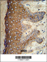 KRT1 Antibody