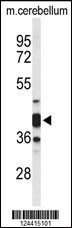 CYTH3 Antibody