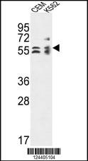 TBCE Antibody