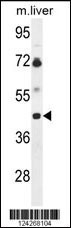 B3GNT5 Antibody