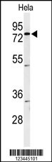 CLPTM1 Antibody