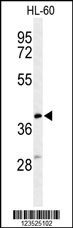 MT-CYB Antibody