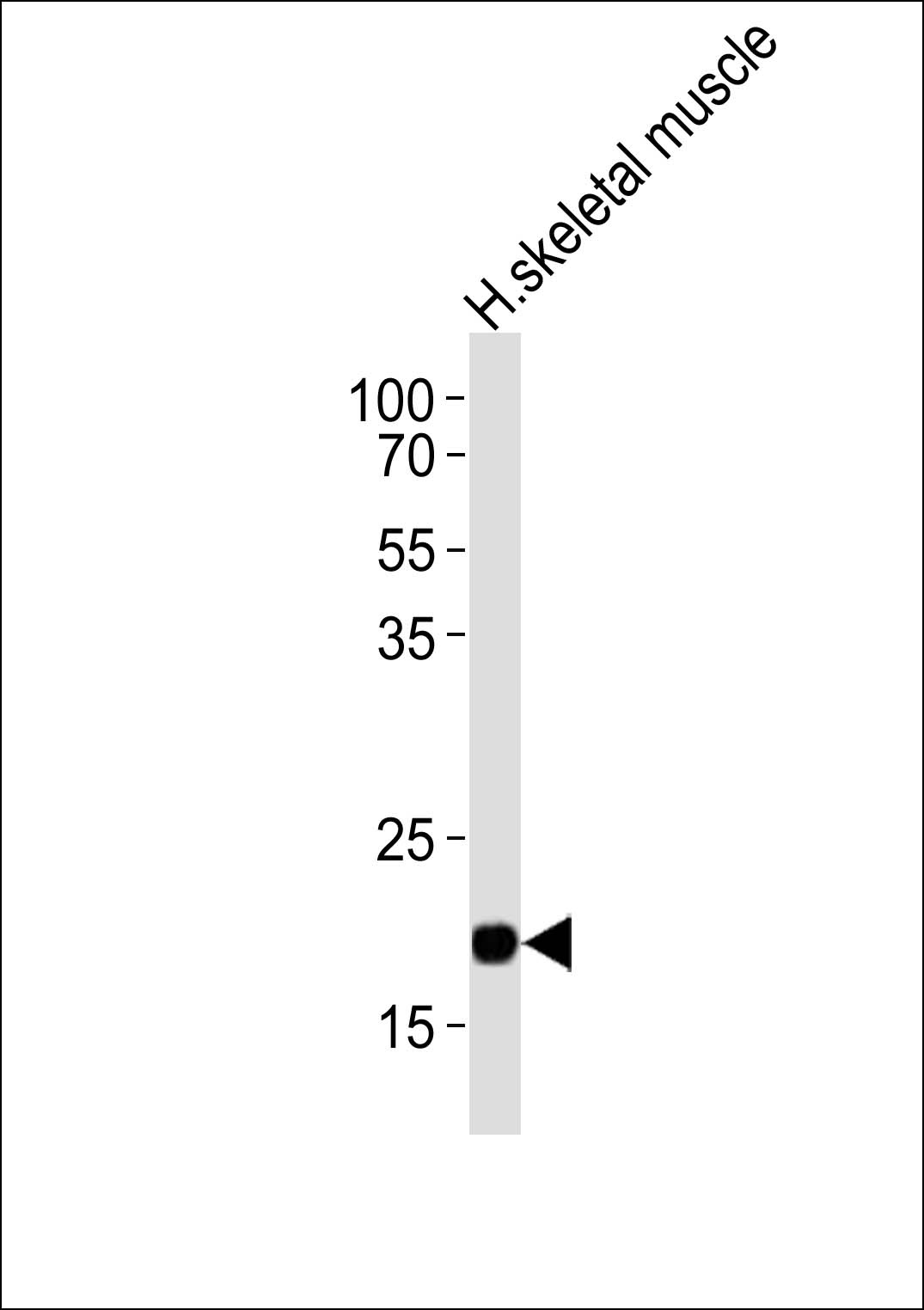 COX6A2 Antibody