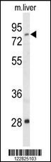 ACSS2 Antibody