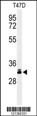 DKK1 Antibody