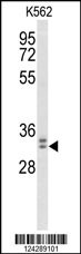 WDR83 Antibody