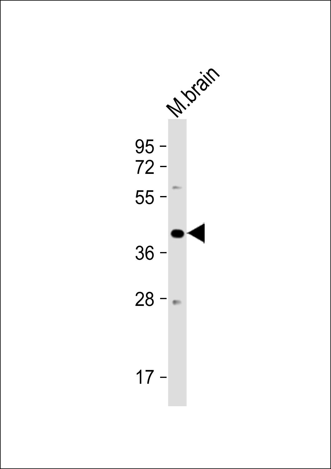 PSG3 Antibody