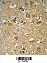 YIPF5 Antibody