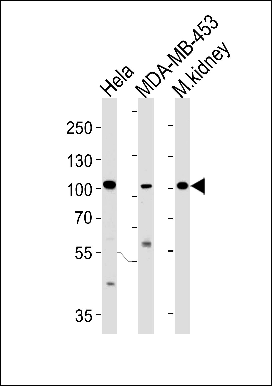 NCOA7 Antibody