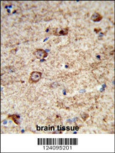 LRRC4 Antibody