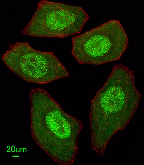 FANCC Antibody