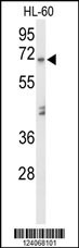 AMY1A Antibody