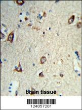 HS3ST2 Antibody