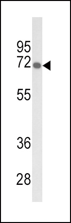 GBE1 Antibody