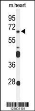 FZD4 Antibody