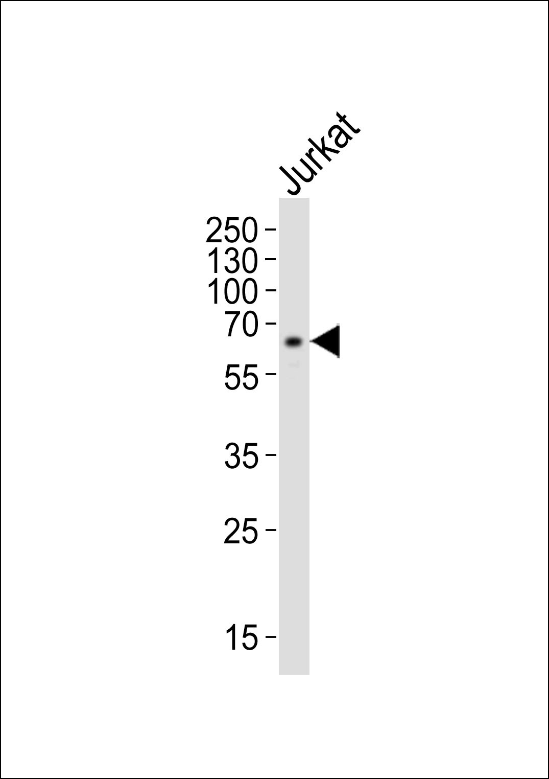 IL2RG Antibody