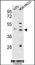 CTSD Antibody