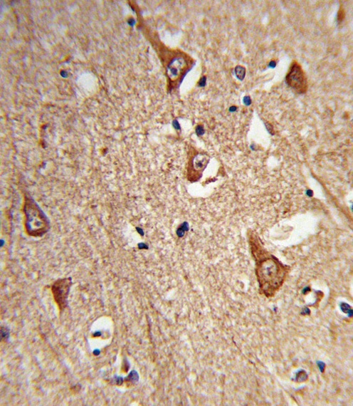 CPLX1 Antibody