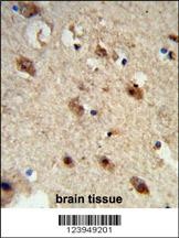 ACP1 Antibody