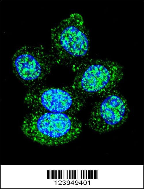 ACP1 Antibody